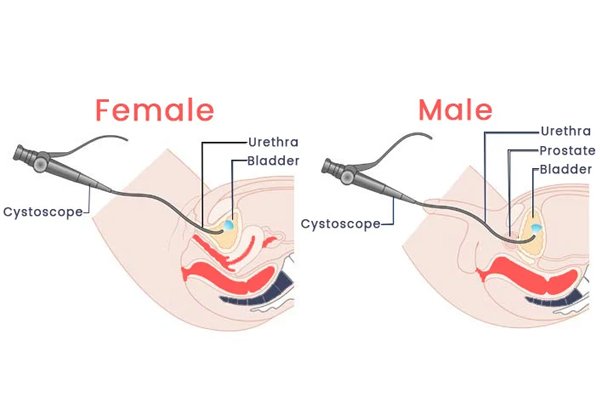 OIU VIU Surgery