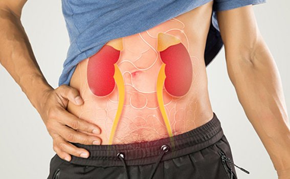 PCNL Procedure