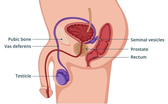 What is Prostate Cancer