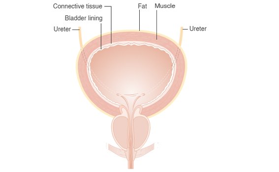Types of Cystectomy