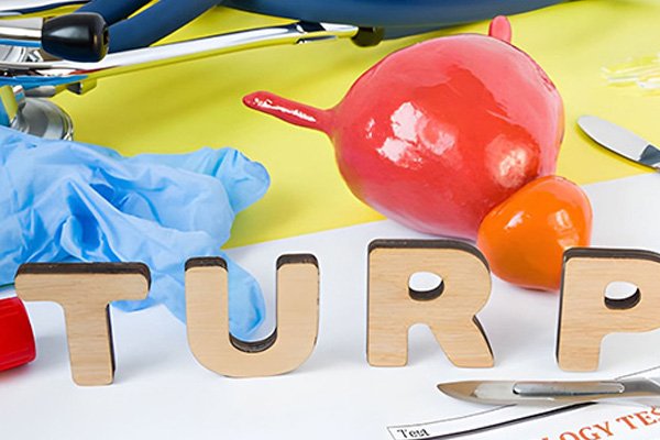 TURP Surgery